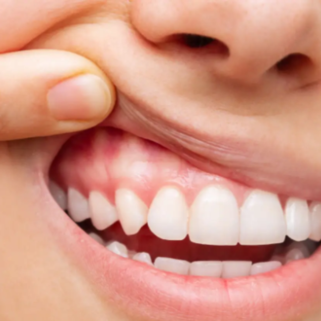 Captura de pantalla 2026-04-23 040605