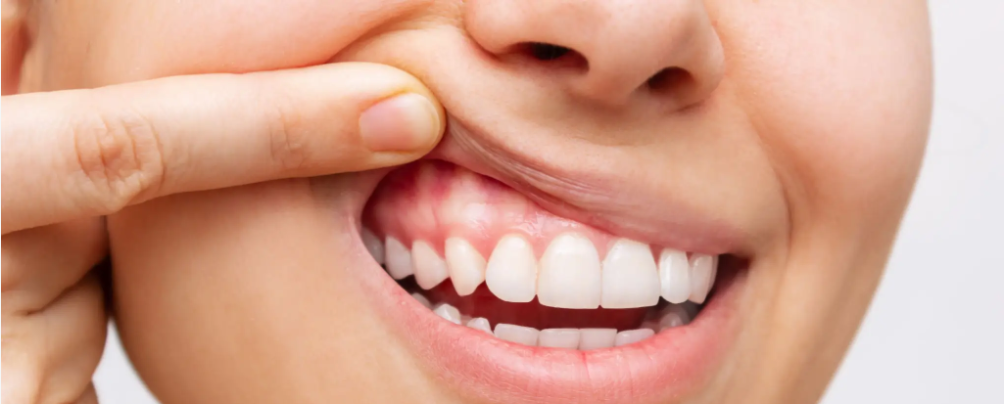 Captura de pantalla 2026-04-23 040605